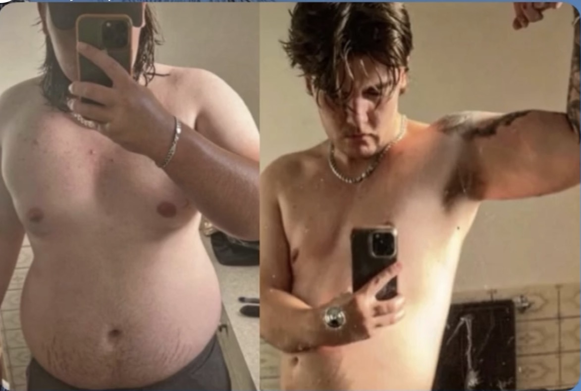 Before and after