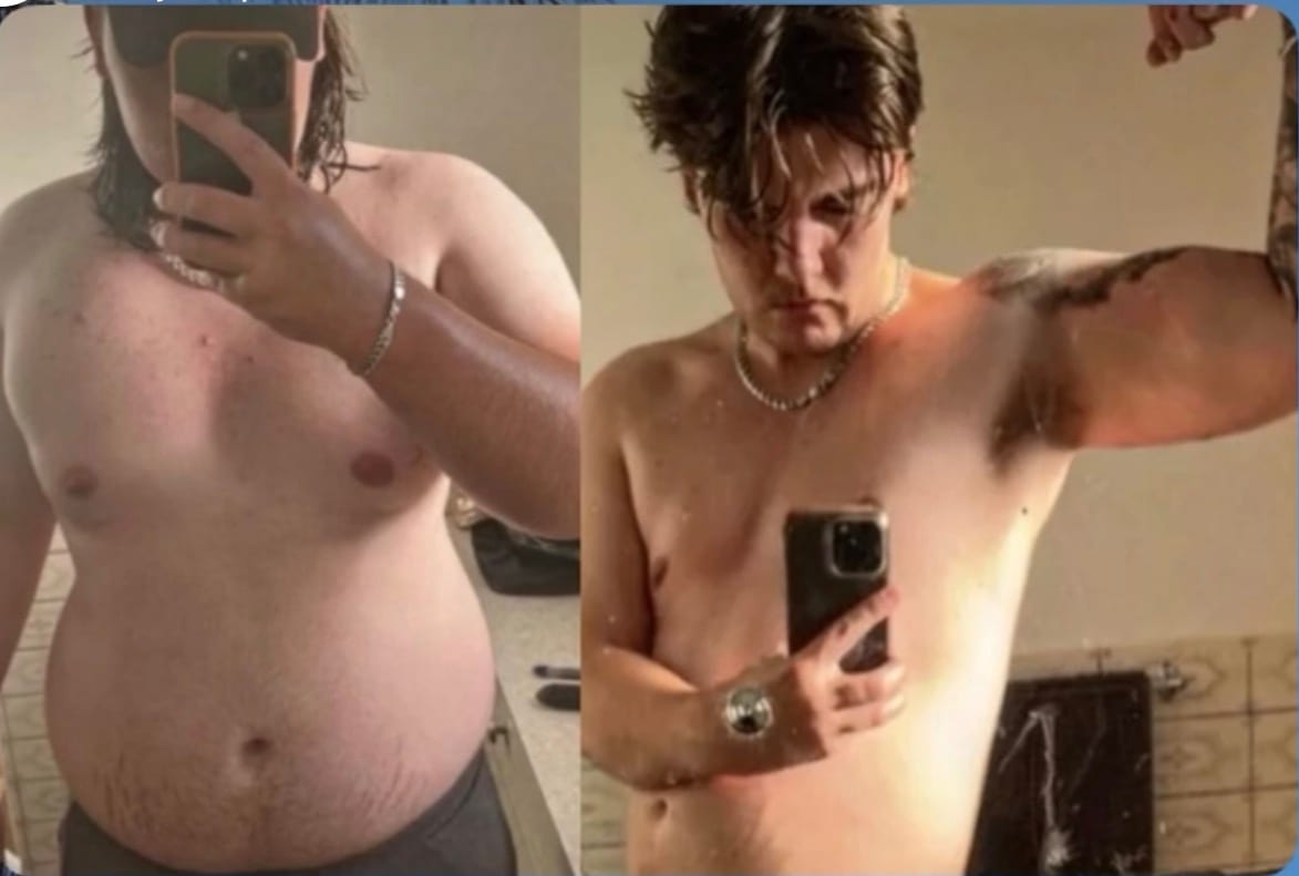 Before and after