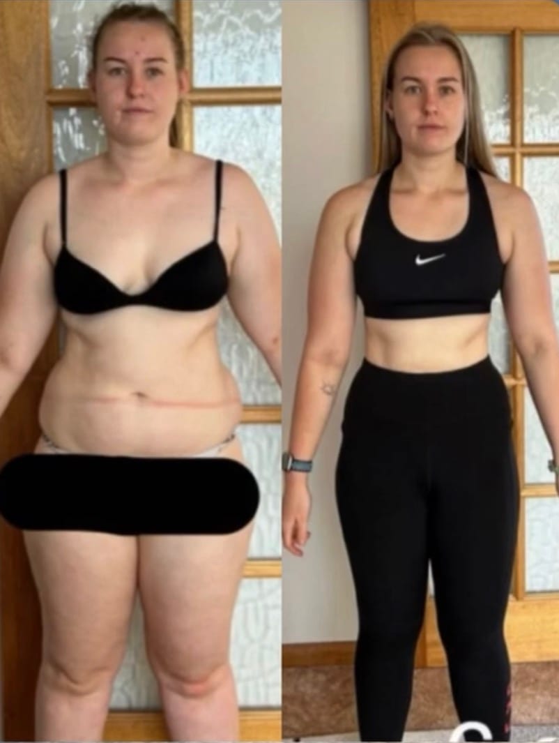 Before and after